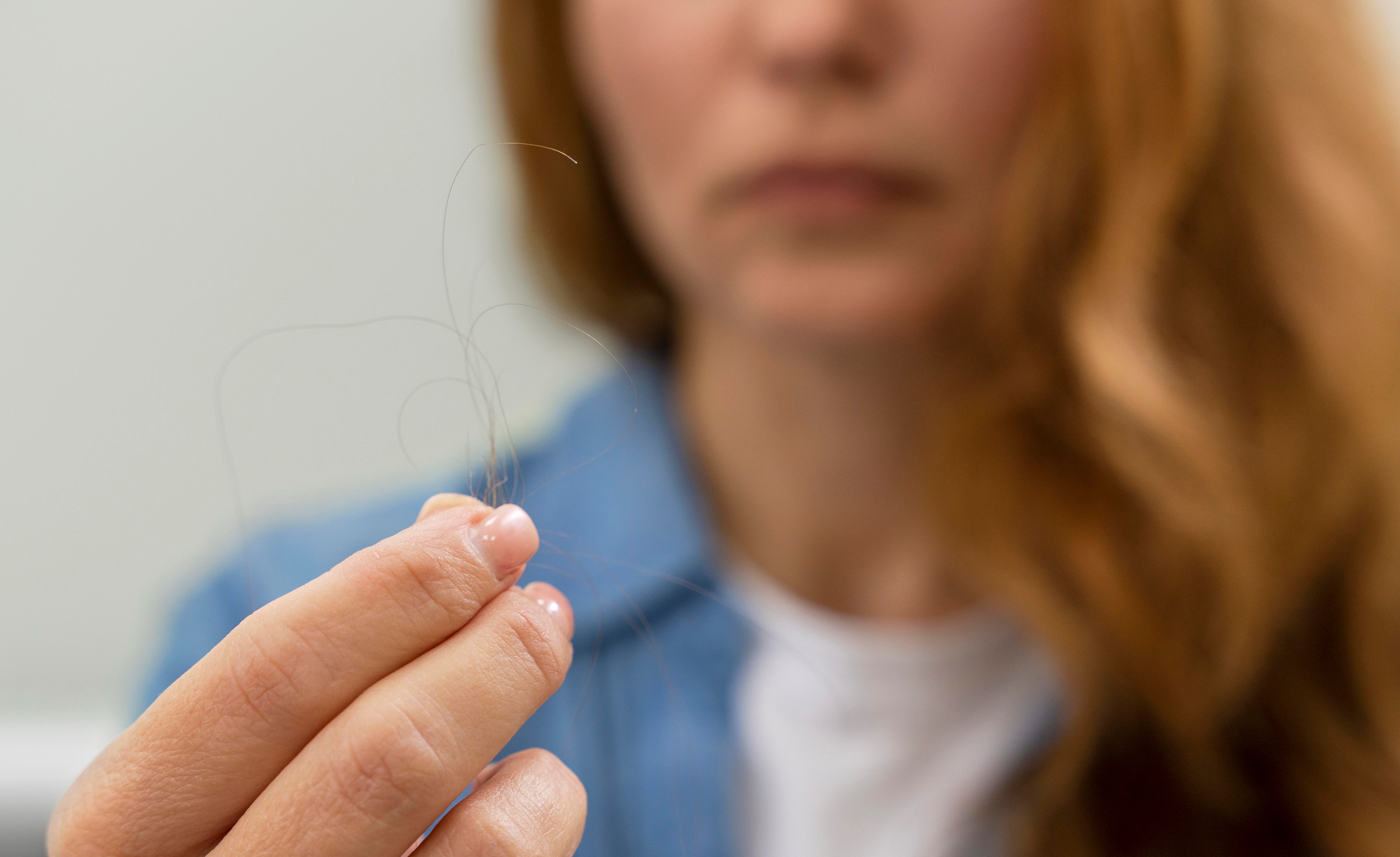 woman-getting-a-hair-loss-treatment-at-a-clinic m.jpg